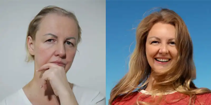 Before and after &mdash; Lena P.